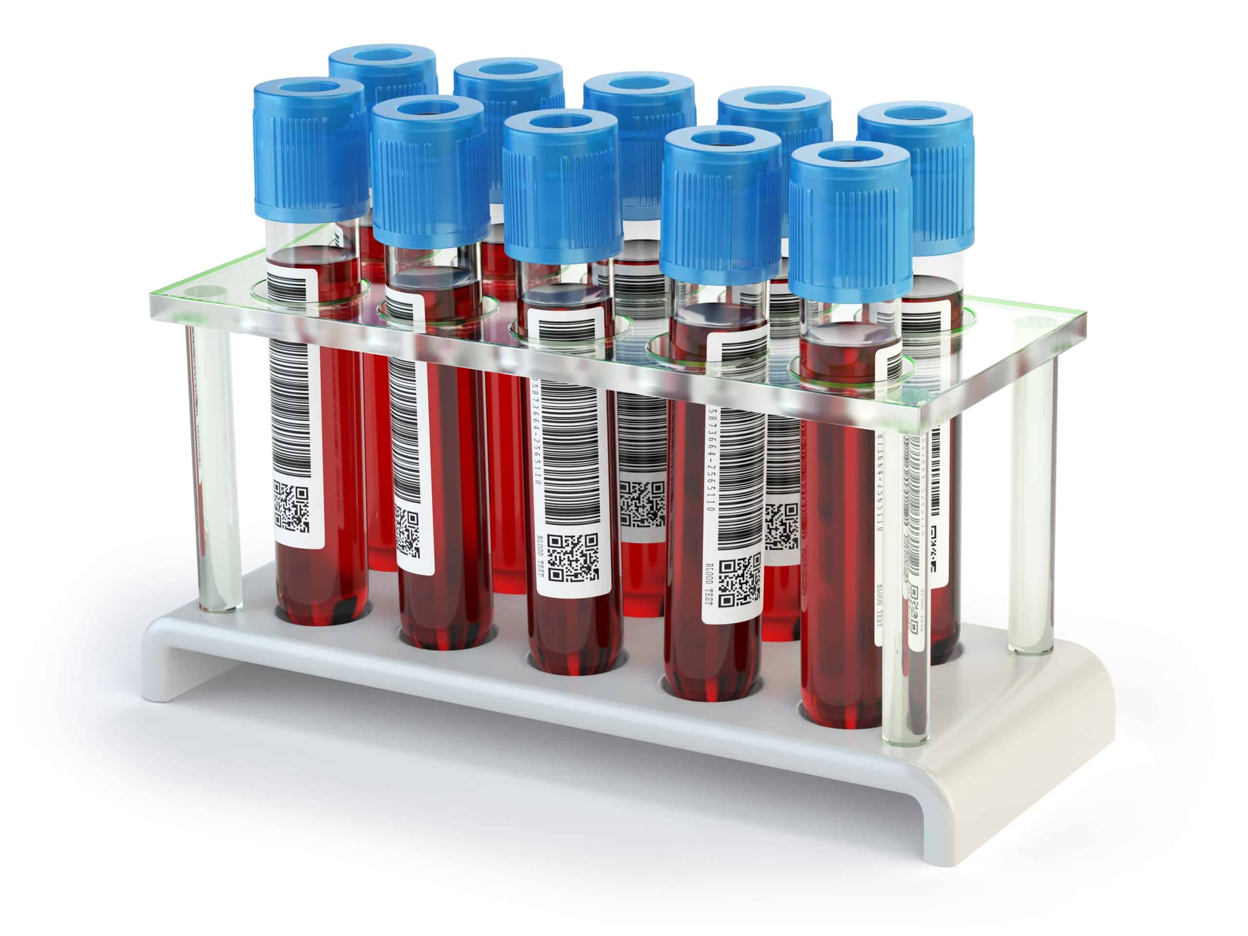 Blood test samples tubes